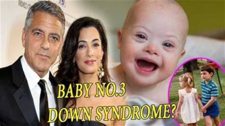 Understanding Clooney's Son And Down Syndrome